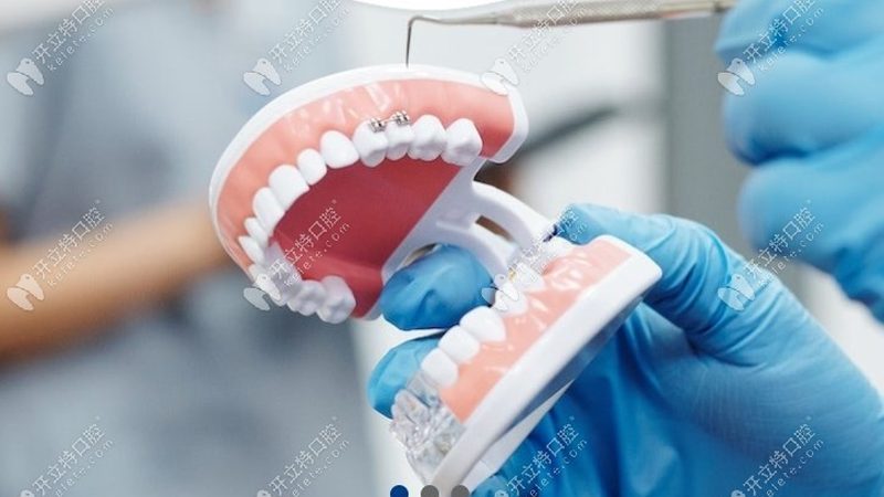 牙结石为何难除？科学洗牙方法解析**